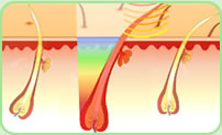 Hair follicles treated with light and heat